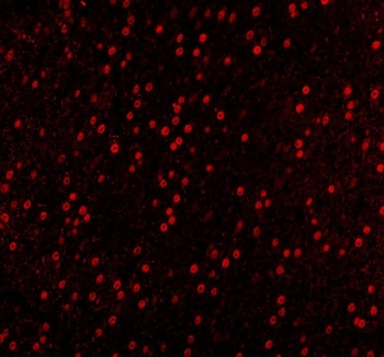 Immunofluorescent staining of FFPE mouse brain tissue with SAM68 antibody (red). HIER: steam section in pH8 EDTA buffer for 20 min.