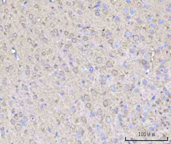 IHC staining of FFPE mouse brain tissue with Rabphilin 3A antibody. HIER: boil tissue sections in pH8 EDTA for 20 min and allow to cool before testing.