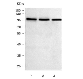Western blot testing of human 1) HeLa, 2) 293T and 3) K562 cell lysate with NCAPH antibody. Predicted molecular weight: ~83 kDa, routinely observed at 90-97 kDa.