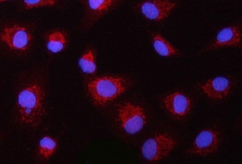 PYCARD Antibody / Inflammasome Adaptor Protein Antibody A549 Cell IF. Immunofluorescent staining of FFPE human A549 cells using PYCARD Antibody / Inflammasome Adaptor Protein Antibody (red) with DAPI nuclear counterstain (blue). PYCARD expression is observed predominantly within the cytoplasm, consistent with its role as an inflammasome adaptor protein that mediates innate immune signaling, ASC speck formation, and inflammatory caspase activation. Heat-induced epitope retrieval was performed by steaming sections in pH 6 citrate buffer for 20 minutes prior to immunofluorescent staining.