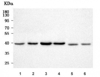 Western blot testing of 1) human HeLa, 2) human 293T, 3) human HepG2, 4) human Jurkat, 5) rat brain and 6) mouse brain tissue lysate with Phosphoserine aminotransferase antibody. Predicted molecular weight: 35-40 kDa (two isoforms).