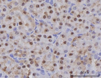 IHC staining of FFPE mouse kidney tissue with Selenocysteine lyase antibody. HIER: boil tissue sections in pH8 EDTA for 20 min and allow to cool before testing.