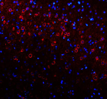 Immunofluorescent staining of FFPE rat brain tissue with NECAB1 antibody (red) and DAPI nuclear stain (blue). HIER: steam section in pH8 EDTA for 20 min.