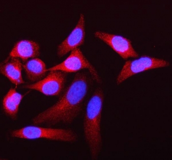 Immunofluorescent staining of FFPE human HeLa cells with Atherin antibody (red) and DAPI nuclear stain (blue). HIER: steam section in pH6 citrate buffer for 20 min.