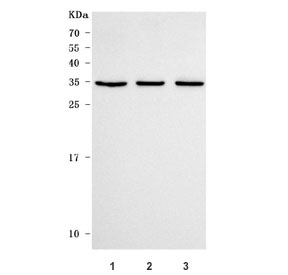 C7orf47 Antibody Human Cell Line Panel WB. Western blot analysis of human 1) Jurkat, 2) SH-SY5Y, and 3) K562 cell lysates using C7orf47 Antibody (PPP1R35 antibody) detects a band at approximately 28 kDa, consistent with the predicted molecular weight of PPP1R35 / C7orf47. The consistent banding pattern across multiple cell lines supports reliable detection of this protein phosphatase regulatory factor involved in phosphorylation-dependent cellular processes.