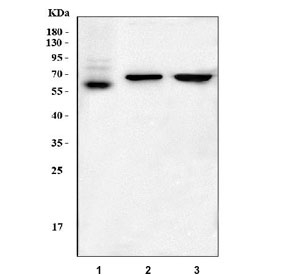 Western blot testing of 1) human A375, 2) rat brain and 3) mouse brain tissue lysate with SOX10 antibody. Expected molecular weight: 50-58 kDa.