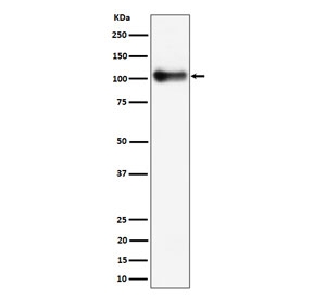 THBD Antibody immunoblotting. Western blot analysis of Thrombomodulin / THBD expression using clone 28T28 antibody in mouse lung tissue lysate. Lane 1: mouse lung lysate. A band is detected at approximately 100 kDa, consistent with the predicted molecular weight of Thrombomodulin / THBD and the known glycosylated form of this endothelial membrane receptor. The predicted molecular weight of the unmodified protein is approximately 60 kDa, while glycosylation commonly results in a higher apparent molecular weight in SDS-PAGE.