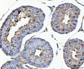 IHC staining of FFPE rat testis tissue with GHRH antibody. HIER: boil tissue sections in pH8 EDTA for 20 min and allow to cool before testing.
