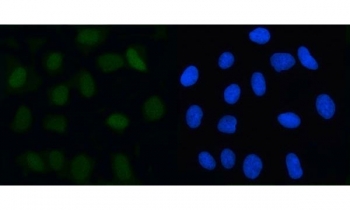 Immunofluorescent staining of FFPE human U-2 OS cells with MAD2B antibody (green) and DAPI nuclear stain (blue). HIER: steam section in pH6 citrate buffer for 20 min.