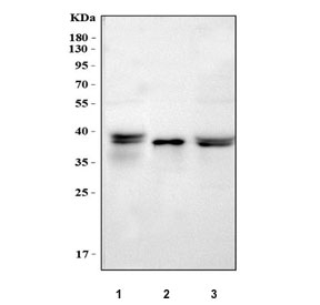 AMBP Antibody for WB. Western blot testing of Lane 1: rat liver lysate, Lane 2: mouse kidney lysate, Lane 3: mouse liver lysate with AMBP antibody. Bands are detected at approximately 26-28 kDa, consistent with the predicted molecular weight of Alpha-1-microglobulin derived from the AMBP precursor protein. A higher band near approximately 39 kDa may correspond to the uncleaved Alpha-1-microglobulin-bikunin precursor (AMBP). As Alpha-1-microglobulin is a glycosylated secreted protein, additional bands at slightly higher apparent molecular weights may be observed due to glycosylation.