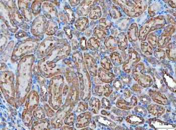 Kallikrein 7 Antibody for Rat IHC and WB immunohistochemistry analysis of KLK7 in rat kidney tissue. FFPE rat kidney tissue was stained using a rabbit polyclonal Kallikrein 7 antibody suitable for rat IHC and WB. Heat induced epitope retrieval was performed by boiling tissue sections in pH 8 EDTA buffer for 20 minutes followed by cooling prior to staining. HRP-DAB brown chromogenic signal highlights KLK7-positive epithelial structures within renal tubules, while nuclei appear blue from hematoxylin counterstain. This staining pattern demonstrates detection of Kallikrein 7 (KLK7), also known as stratum corneum chymotryptic enzyme, in rat tissue and supports use of Kallikrein 7 Antibody for Rat IHC and WB for immunohistochemistry studies in rat experimental models.