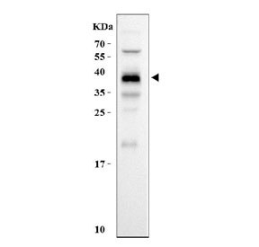 Kallikrein 7 Antibody for Rat IHC and WB western blot analysis of KLK7 in rat kidney tissue. Rat kidney tissue lysate was resolved by SDS-PAGE and probed using a rabbit polyclonal Kallikrein 7 antibody suitable for rat IHC and WB. A band is detected at approximately 40 kDa, which is higher than the predicted molecular weight of Kallikrein 7 (KLK7) at approximately 29 kDa. This upward shift is consistent with glycosylation and post-translational processing commonly reported for secreted kallikrein family proteases. KLK7, also known as stratum corneum chymotryptic enzyme, is synthesized as a secreted preproenzyme and undergoes proteolytic maturation and glycosylation that can alter apparent migration during SDS-PAGE. Detection of KLK7 in rat tissue lysate supports the use of Kallikrein 7 Antibody for Rat IHC and WB Rabbit Polyclonal for western blot analysis in rat experimental models studying kallikrein protease biology and epithelial tissue function.