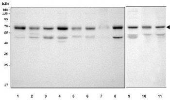 Western blot testing of 1) human HeLa, 2) human Jurkat, 3) human PC-3, 4) human 293T, 5) monkey COS-7, 6) human HEL, 7) human U-2 OS, 8) human SH-SY5Y, 9) rat C6, 10) mouse thymus and 11) mouse NIH 3T3 cell lysate with TR4 antibody. Test shows the expected full-length ~65-67 kDa band along with additional lower bands at ~50-55 kDa, consistent with N-terminally truncated TR4 isoforms generated by alternative initiation or limited proteolysis.