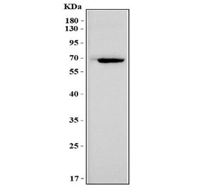 Western blot analysis of Msln antibody in mouse heart tissue lysate. A distinct band is observed at approximately 65-70 kDa, consistent with the predicted molecular weight of Mesothelin at approximately 69 kDa. Mesothelin is a glycoprotein and post-translational modification, including glycosylation, may contribute to minor apparent molecular weight variation on SDS-PAGE. This antibody is designed for mouse sample detection.