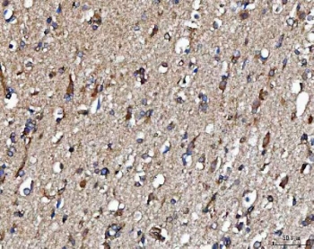 IHC staining of FFPE human brain tissue with METAP2 antibody. HIER: boil tissue sections in pH8 EDTA for 20 min and allow to cool before testing.