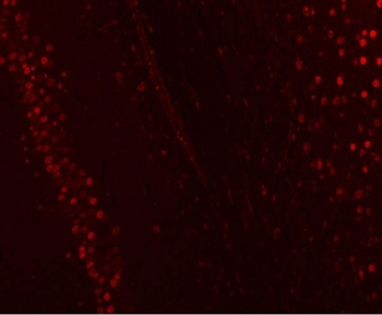 Immunofluorescent staining of FFPE rat brain tissue with NUCKS1 antibody (red). HIER: steam section in pH8 EDTA buffer for 20 min.