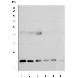 Western blot testing of 1) human 293T, 2) human SH-SY5Y, 3) human MCF7, 4) human A431, 5) rat liver and 6) mouse liver tissue lysate with NUCKS1 antibody. Predicted molecular weight ~23 kDa, ~27 kDa (two isoforms).