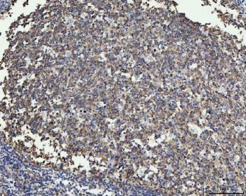 MMP19 Antibody Human Tonsil IHC. Immunohistochemistry staining of FFPE human tonsil using MMP19 antibody demonstrates widespread cytoplasmic staining throughout lymphoid cell populations, with particularly prominent immunoreactivity within germinal center-associated regions. Matrix Metalloproteinase 19 (MMP19) is a tissue remodeling protein that regulates extracellular matrix turnover, cellular migration, and interactions between immune cells and their surrounding microenvironment. The observed staining pattern is consistent with the established role of matrix metalloproteinases in tissue organization, extracellular matrix regulation, and dynamic remodeling processes within lymphoid tissues. These findings support the utility of MMP19 antibody for studies of tissue remodeling, extracellular matrix biology, and immune-associated cellular behavior. HIER: boil tissue sections in pH8 EDTA for 20 min and allow to cool before testing.