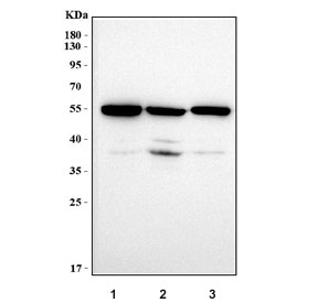 MMP19 Antibody Human Cell Line WB. Western blot analysis of human SH-SY5Y, 293T, and HeLa cell lysates using MMP19 antibody demonstrates a prominent immunoreactive band at approximately 57 kDa, consistent with the expected molecular weight of Matrix Metalloproteinase 19 (MMP19). MMP19 is a tissue remodeling protein that regulates extracellular matrix turnover, cellular migration, and interactions between cells and their surrounding microenvironment. The observed expression across multiple human cell lines supports the utility of this antibody for investigating extracellular matrix regulation, tissue organization, and remodeling-associated signaling pathways. Predicted molecular weight: ~57 kDa.