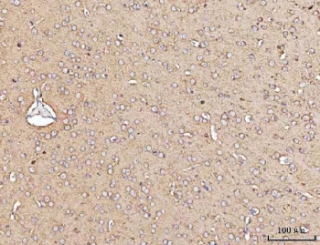 IHC staining of FFPE mouse brain tissue with MARK3 antibody. HIER: boil tissue sections in pH8 EDTA for 20 min and allow to cool before testing.
