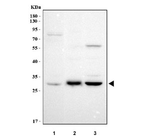 Western blot testing of 1) human A549, 2) rat liver and 3) rat kidney tissue lysate with NIT2 antibody. Predicted molecular weight ~31 kDa.