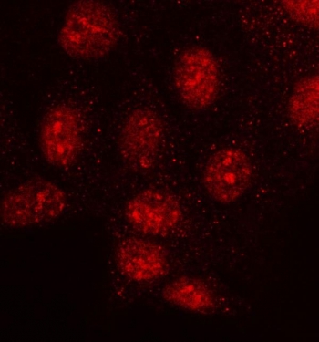 Immunofluorescent staining of FFPE human HeLa cells with MMS19 antibody (red). HIER: steam section in pH6 citrate buffer for 20 min.