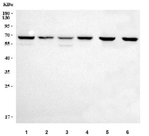 Western blot testing of 1) human 293T, 2) human HepG2, 3) human PC-3, 4) human U-2 OS, 5) rat testis and 6) mouse testis tissue lysate with Paraspeckle component 1 antibody. Predicted molecular weight ~59 kDa and ~46 kDa (two isoforms).