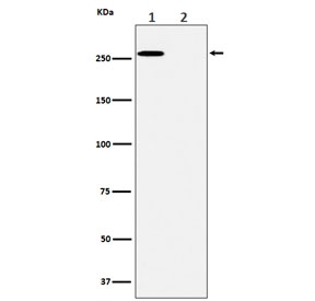 Phospho-ACACA (Ser79) Antibody for WB. Western blot analysis of ACACA / Acetyl-CoA carboxylase 1 phosphorylation in human A431 cell lysate using Phospho-ACACA (Ser79) Antibody - metabolic stress marker (clone 28A12). Lane 1: untreated lysate, Lane 2: lysate treated with lambda protein phosphatase. A band is detected at approximately 260 kDa in the untreated sample, consistent with phosphorylated ACC1, while signal is abolished following phosphatase treatment, confirming phosphorylation-dependent detection at Ser79 and supporting specificity for the inhibited form of ACC1 associated with suppressed lipogenesis.
