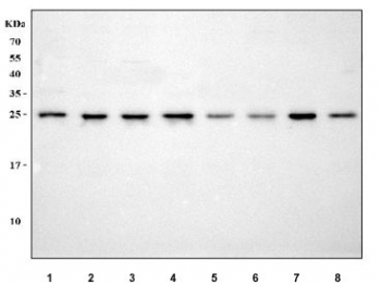 Western blot testing of human 1) HeLa, 2) 293T, 3) HepG2, 4) Jurkat, 5) HaCaT, 6) U-251, 7) SH-SY5Y and 8) K562 cell lysate with MIS12 antibody. Predicted molecular weight ~24 kDa.