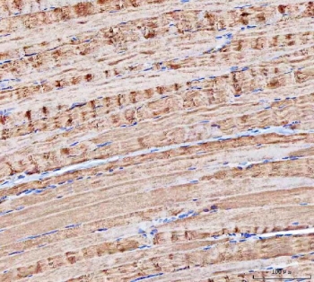 IHC staining of FFPE human skeletal muscle tissue with MOCS2 antibody. HIER: boil tissue sections in pH8 EDTA for 20 min and allow to cool before testing.
