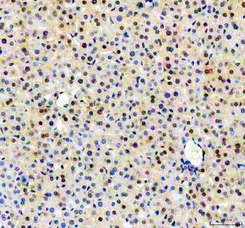 IHC staining of FFPE mouse liver tissue with NUDT5 antibody. HIER: boil tissue sections in pH8 EDTA for 20 min and allow to cool before testing.