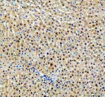 IHC staining of FFPE rat liver tissue with NUDT5 antibody. HIER: boil tissue sections in pH8 EDTA for 20 min and allow to cool before testing.