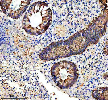 IHC staining of FFPE human appendix tissue with Keratin 19 antibody. HIER: boil tissue sections in pH8 EDTA for 20 min and allow to cool before testing.