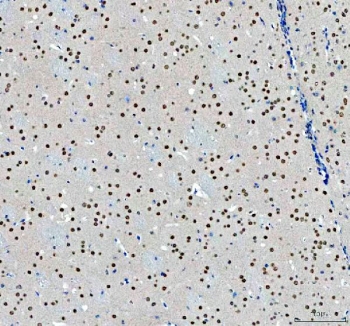 IHC staining of FFPE mouse brain tissue with NCOA5 antibody. HIER: boil tissue sections in pH8 EDTA for 20 min and allow to cool before testing.