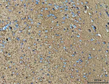 IHC staining of FFPE human mouse brain tissue with NPEPPS antibody. HIER: boil tissue sections in pH8 EDTA for 20 min and allow to cool before testing.