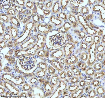 IHC staining of FFPE rat kidney tissue with GCLM antibody. HIER: boil tissue sections in pH8 EDTA for 20 min and allow to cool before testing.