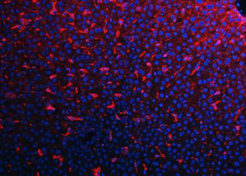 Immunofluorescent staining of FFPE rat liver tissue with Adgre1 antibody (red) and DAPI nuclear stain (blue). HIER: steam section in pH8 EDTA buffer for 20 min.