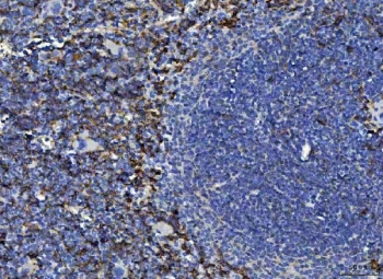 IHC staining of FFPE mouse spleen tissue with Adgre1 antibody. HIER: boil tissue sections in pH8 EDTA for 20 min and allow to cool before testing.