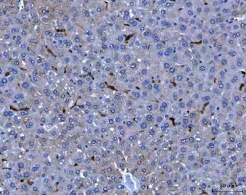 IHC staining of FFPE mouse liver tissue with Adgre1 antibody. HIER: boil tissue sections in pH8 EDTA for 20 min and allow to cool before testing.