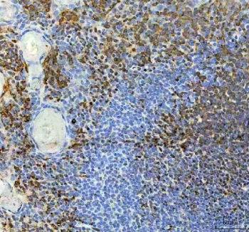 IHC staining of FFPE human tonsil tissue with NRMT antibody. HIER: boil tissue sections in pH8 EDTA for 20 min and allow to cool before testing.
