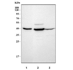Prostaglandin Reductase 2 Antibody Western Blot. Western blot analysis of human MCF7 (lane 1), RT4 (lane 2), and Caco-2 (lane 3) cell lysates using Prostaglandin Reductase 2 Antibody demonstrates a distinct band at approximately 38-40 kDa, consistent with the predicted molecular weight of PTGR2. Prostaglandin Reductase 2 is an NADPH-dependent oxidoreductase involved in prostaglandin metabolism and the regulation of eicosanoid signaling pathways. Detection of the expected molecular weight band across multiple human cell lines supports expression of PTGR2 and the utility of this antibody for western blot applications.