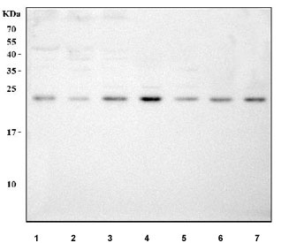 Western blot testing of human 1) SiHa, 2) RT4, 3) MCF7, 4) 293T, 5) Jurkat, 6) A431 and 7) Caco-2 cell lysate with MED29 antibody. Predicted molecular weight ~21 kDa.