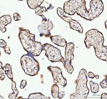 IHC staining of FFPE human placental tissue with NUBPL antibody. HIER: boil tissue sections in pH8 EDTA for 20 min and allow to cool before testing.