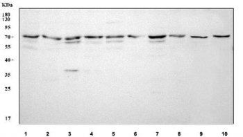 Western blot testing of 1) human HeLa, 2) human A431, 3) human HEL, 4) human A549, 5) human K562, 6) human PC-3, 7) human MCF7, 8) human U-2 OS, 9) rat C6 and 10) mouse Neuro-2a cell lysate with CML66 antibody. Predicted molecular weight: 57-67 kDa (multiple isoforms).