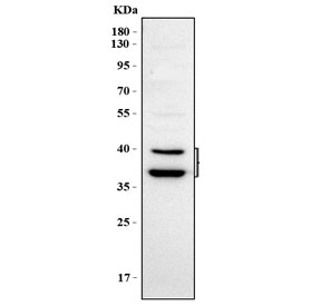 Western blot testing of human HEL cell lysate with PSTPIP2 antibody. Predicted molecular weight ~39/36 kDa (two isoforms).