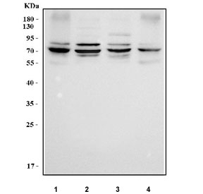 Western blot testing of human 1) SiHa, 2) U-87 MG, 3) A431 and 4) HaCaT cell lysate with RSPH3 antibody. Predicted molecular weight ~64 kDa and ~53 kDa (two isoforms).