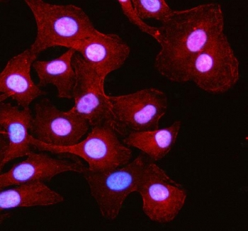 Immunofluorescent staining of FFPE human A549 cells with RSPH3 antibody (red) and DAPI nuclear stain (blue). HIER: steam section in pH6 citrate buffer for 20 min.