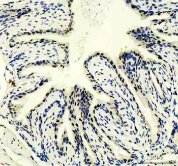 IHC staining of FFPE mouse bladder tissue with PUS7 antibody, HRP-secondary and DAB substrate. HIER: boil tissue sections in pH8 EDTA for 20 min and allow to cool before testing.