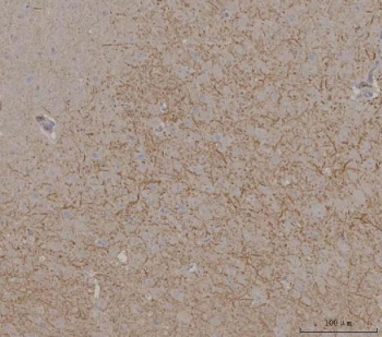 IHC staining of FFPE mouse brain tissue with PRRT1 antibody. HIER: boil tissue sections in pH8 EDTA for 20 min and allow to cool before testing.