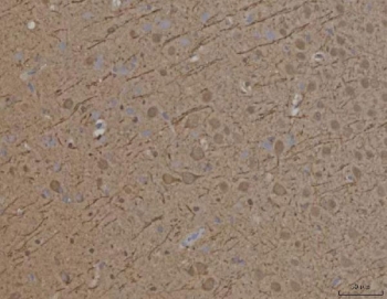 IHC staining of FFPE rat brain tissue with PRRT1 antibody. HIER: boil tissue sections in pH8 EDTA for 20 min and allow to cool before testing.